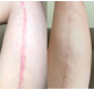 Antes e depois - Maria Cecilia Silva